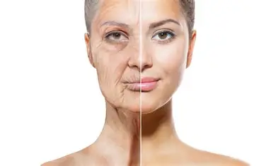 Resultado de imagen de Retardar El Envejecimiento